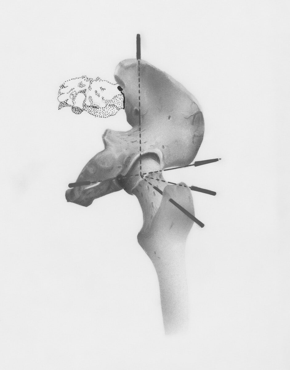 a black and white photo of a human skull